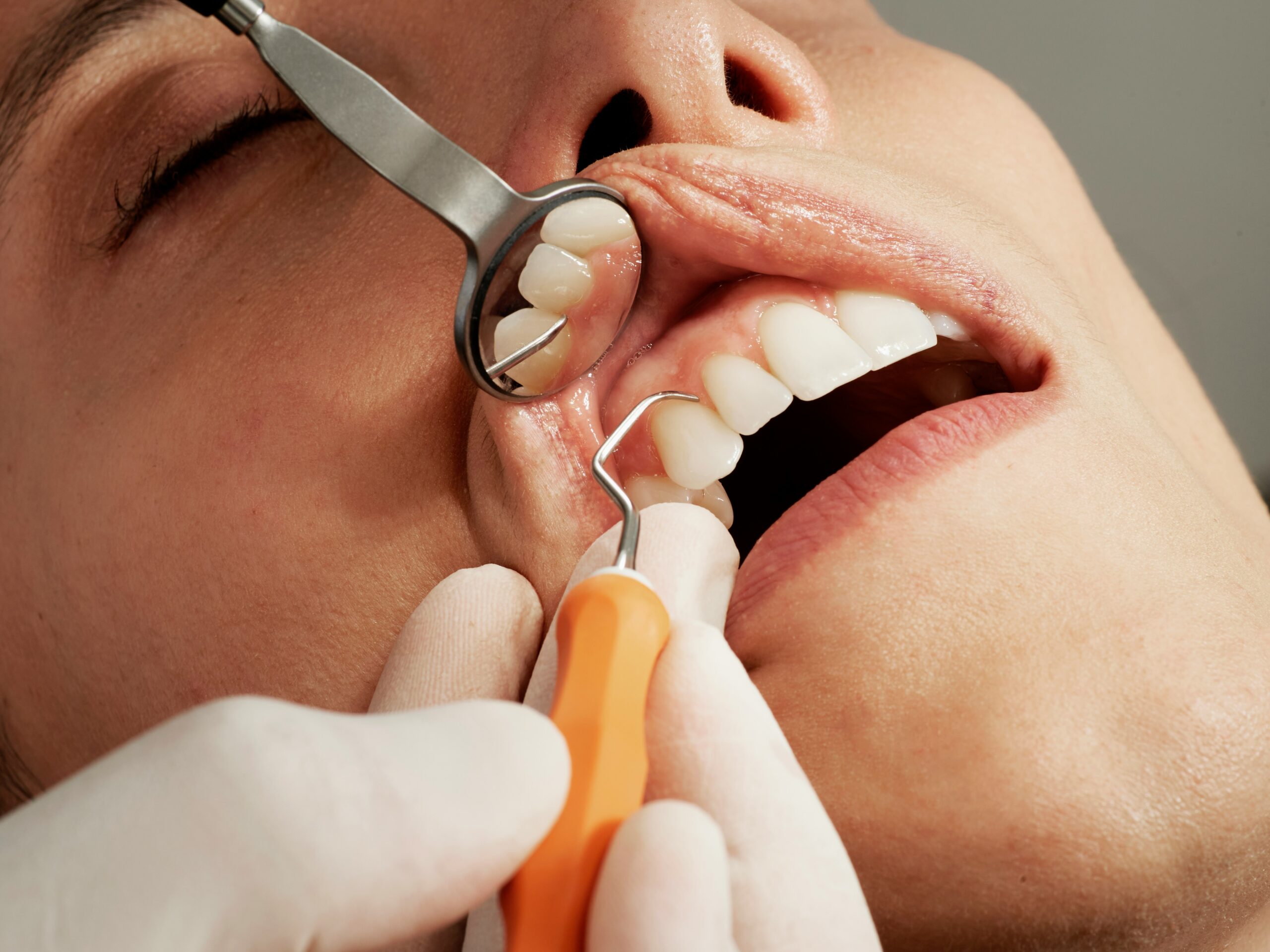 How to Remove Tartar From Teeth Without Dentist Visits guide to brushing, flossing, plaque management, oral hygiene, and tartar prevention.